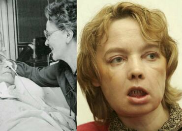 10 cirugías que revolucionaron el mundo de la medicina