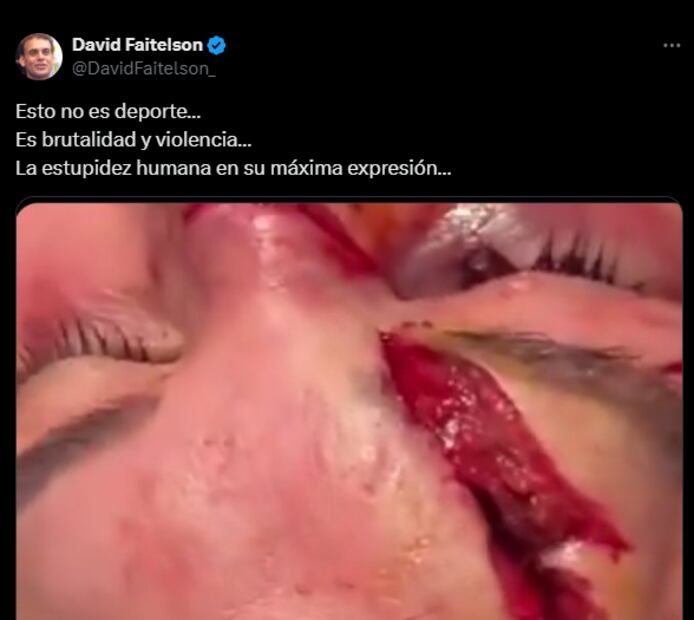 David Faitelson dijo que las peleas de UFC no son un deporte. Foto: @DavidFaitelson_