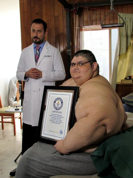 El “hombre más obeso del mundo” es mexicano y lucha por perder peso