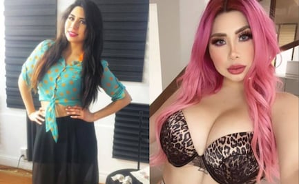 “La Bebeshita”: El antes y después de sus múltiples cirugías