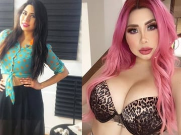 “La Bebeshita”: El antes y después de sus múltiples cirugías