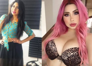 “La Bebeshita”: El antes y después de sus múltiples cirugías