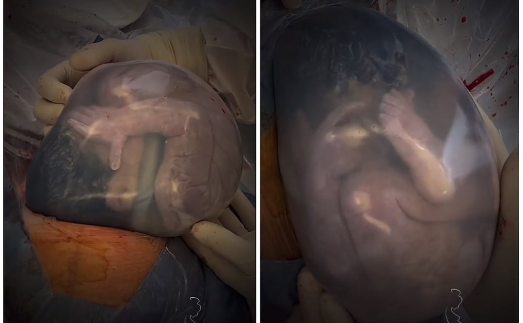 Foto: Instagram @nachoptomasone