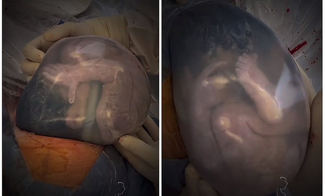 Foto: Instagram @nachoptomasone