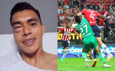 Tala Rangel mostró como le quedó el ojo luego del golpe que le propinó el Pollo Briseño