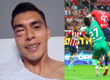 Tala Rangel mostró como le quedó el ojo luego del golpe que le propinó el Pollo Briseño