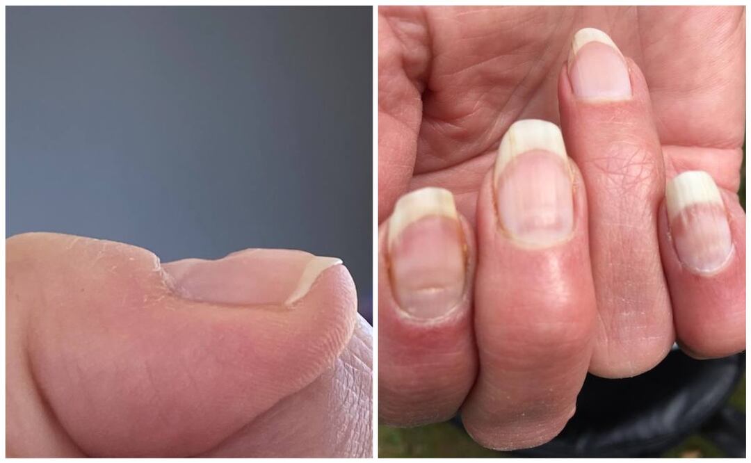 Fotos: Twitter @stephentrew/@timspector