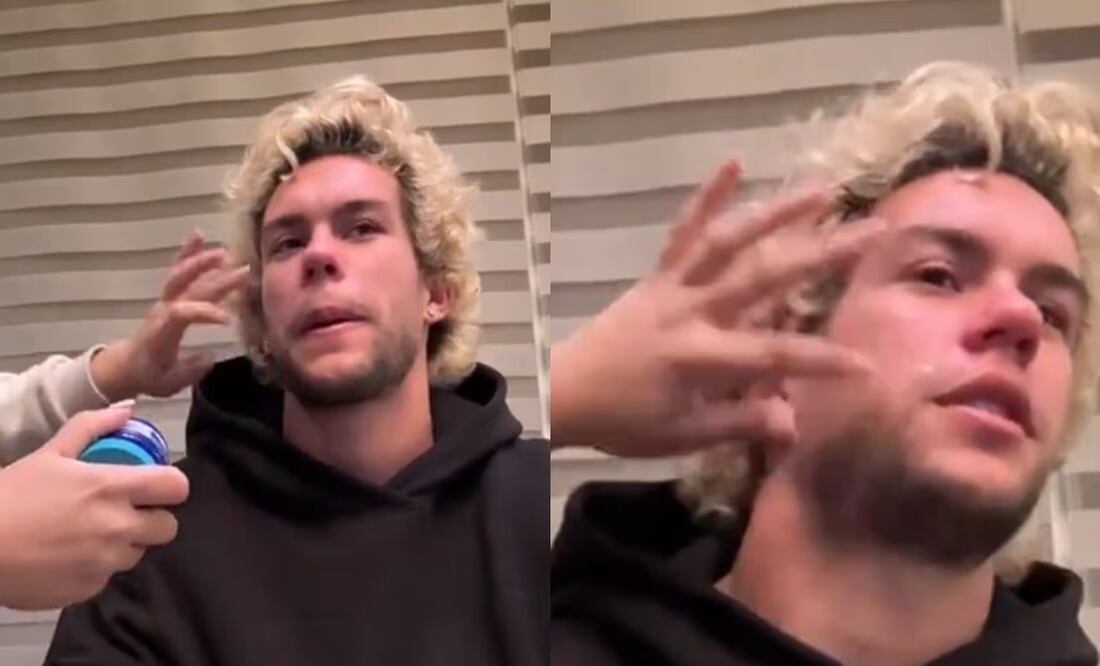 Cade Cowell recibiendo remedio casero - Foto: Especial