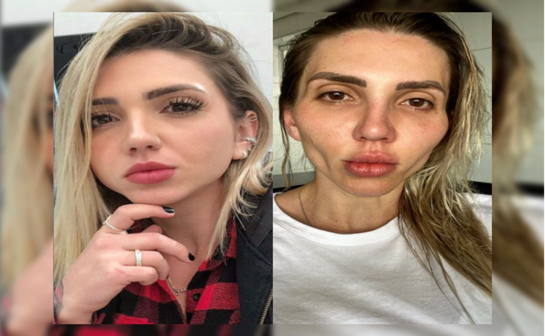 Foto: Instagram @eusoufrozza