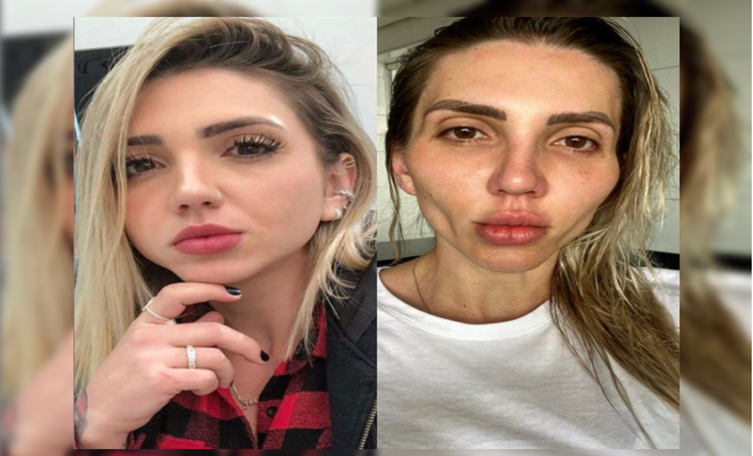 Foto: Instagram @eusoufrozza