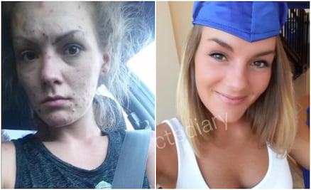El antes y después de 10 adictos que dejaron las drogas