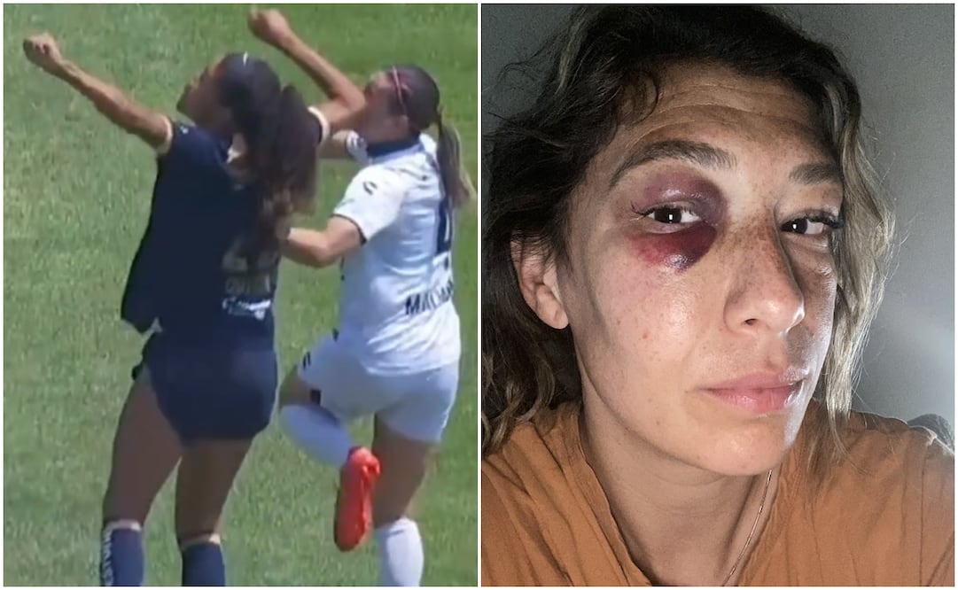 Jugada de Mónica Alvarado en codazo y foto de su ojo / FOTO: Captura y Twitter @moni_alvarado8