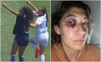 Jugadora de Xolos Femenil arremete contra la Liga MX y el arbitraje: 'No me sentí protegida'