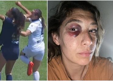 Jugadora de Xolos Femenil arremete contra la Liga MX y el arbitraje: 'No me sentí protegida'