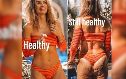 Las fotos de la influencer que muestra sus "imperfecciones"