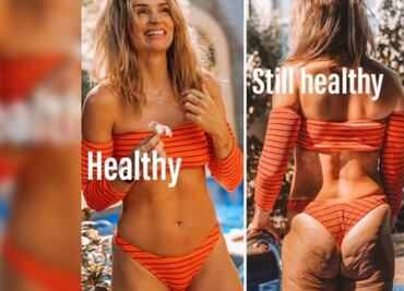 Las fotos de la influencer que muestra sus "imperfecciones"