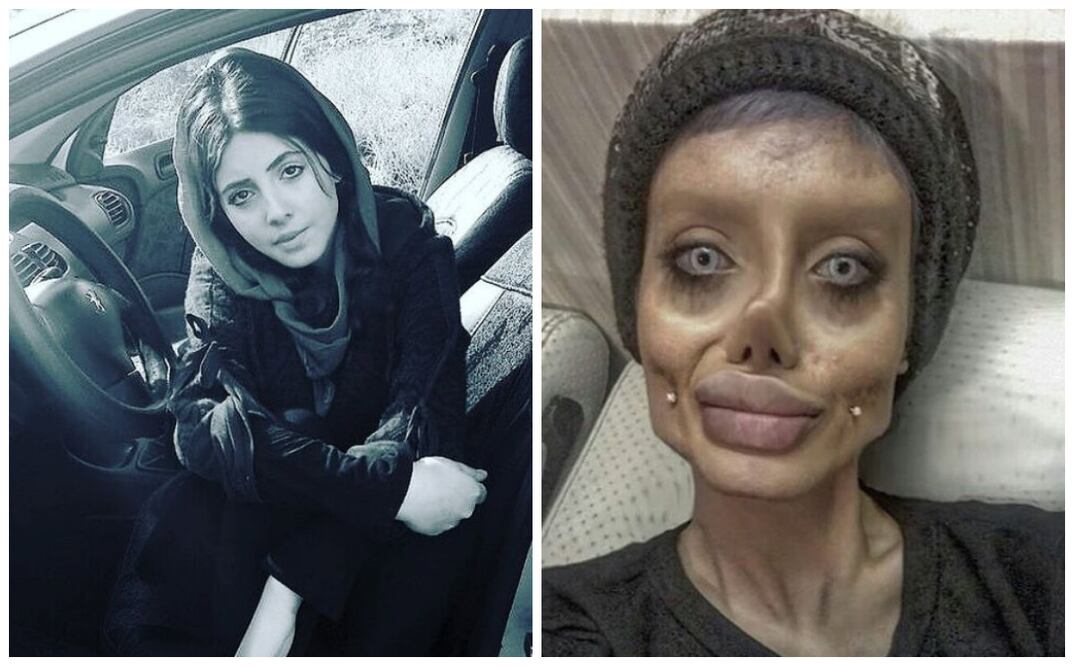 Fotos: Instagram @sahartabar.offcial y @sahartabar.before