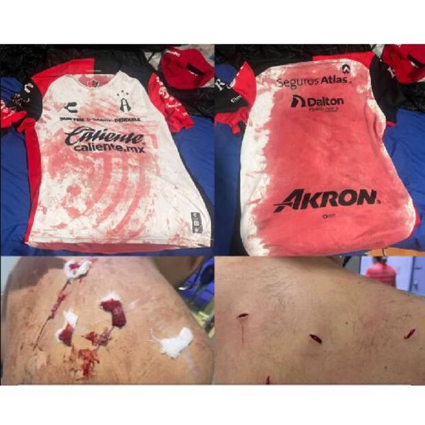 Un aficionado del Atlas denunció que fue agredido con una  navaja en el estadio de las Chivas. Foto: Especial