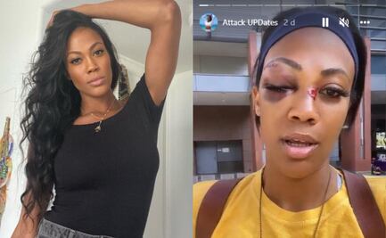 Video: Atleta olímpica es atacada por vagabundo en Los Ángeles