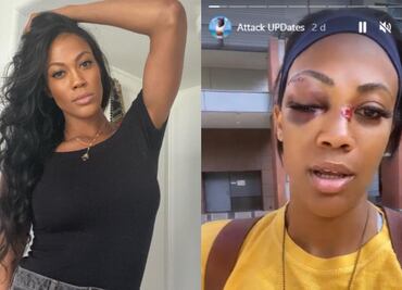 Video: Atleta olímpica es atacada por vagabundo en Los Ángeles