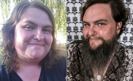 Rose Geil luchó 20 años contra el vello facial, hoy es feliz con su barba