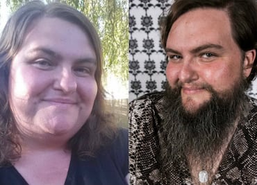 Rose Geil luchó 20 años contra el vello facial, hoy es feliz con su barba