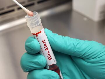 Brasil, México y Perú son los países con más casos de viruela del mono en Latinoamérica