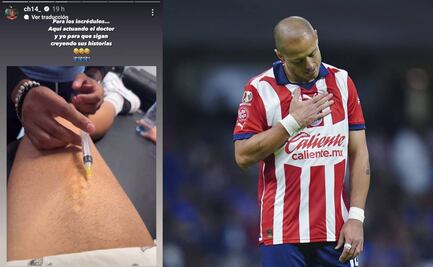 Chicharito Hernández demostró que sí está lesionado y por eso no puede jugar con Chivas
