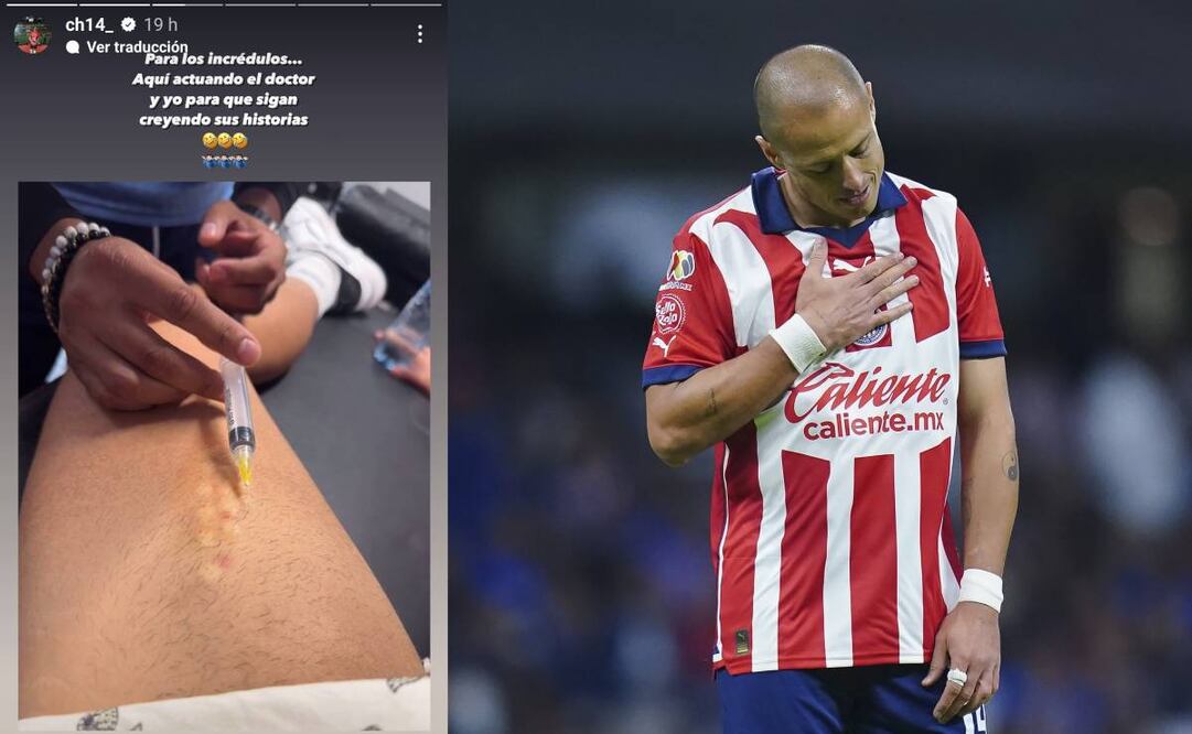 Chicharito Hernández mostró parte de la rehabilitación de su lesión con Chivas. Foto: Especial