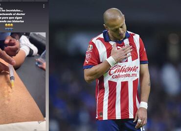 Chicharito Hernández demostró que sí está lesionado y por eso no puede jugar con Chivas