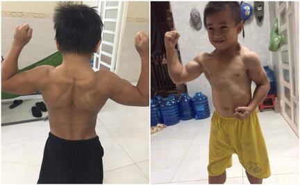 ¡Niño musculoso! Parece fisicoculturista por una rara enfermedad