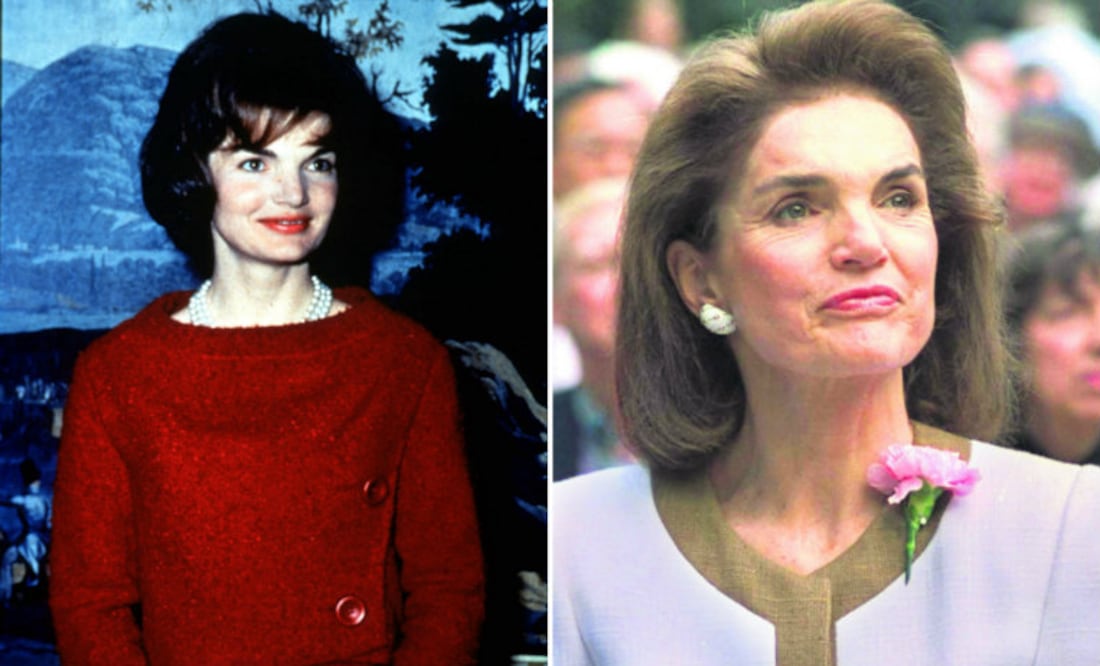 Fotos: AP/El Universal