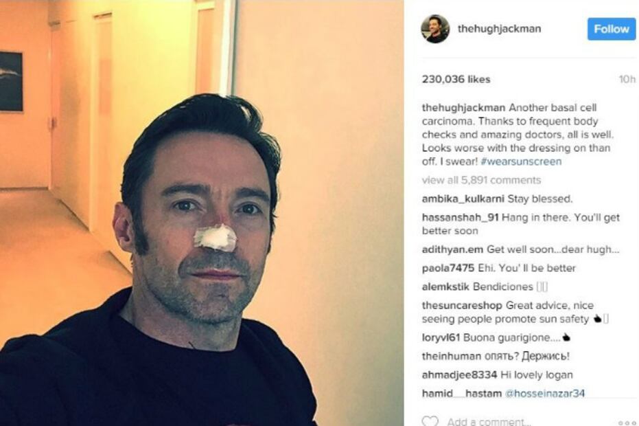Hugh Jackman ha padecido cuatro tipos de cáncer en la piel... ¡Él sigue luchando!