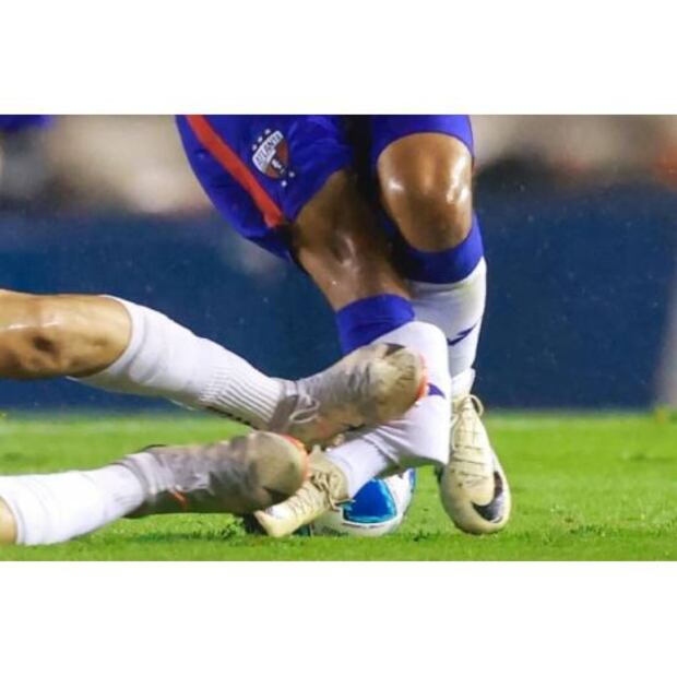 Luis Ruiz Bustillos le propinó esta brutal lesión al Hobbit Bermúdez. Foto: Especial