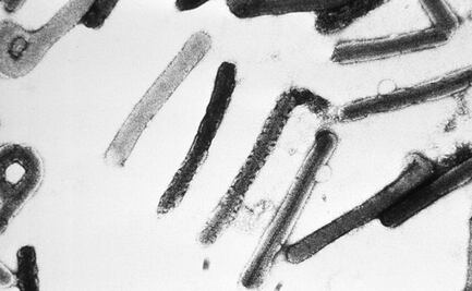 África registra primer caso de enfermedad causada por el virus Marburgo