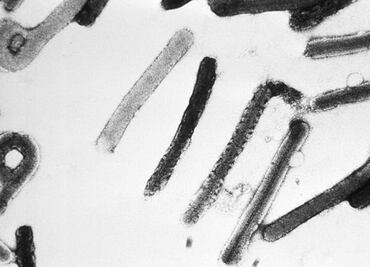 África registra primer caso de enfermedad causada por el virus Marburgo