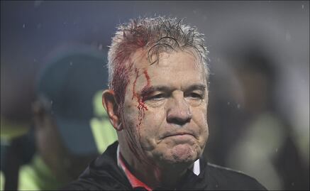 Javier Aguirre sufre fuerte agresión por parte de la afición de Honduras y termina descalabrado