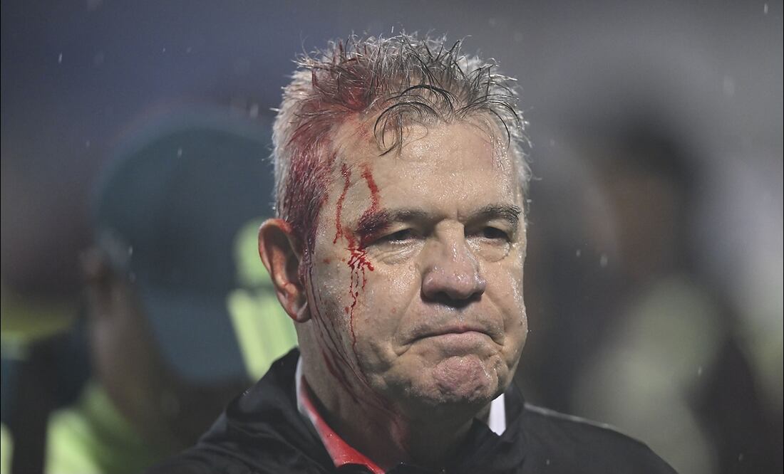 Javier Aguirre sufrió fuerte agresión por parte de los seguidores de Honduras y terminó descalabrado / FOTO: Imago7