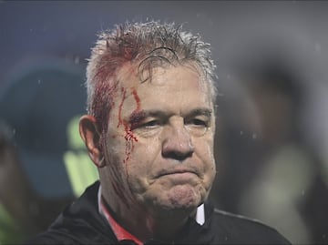 Javier Aguirre sufre fuerte agresión por parte de la afición de Honduras y termina descalabrado
