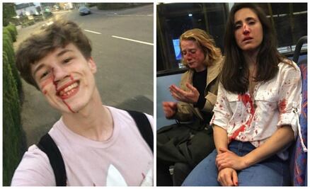 10 lamentables ataques homofóbicos que demuestran el camino que falta recorrer