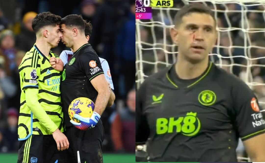 El Dibu Martínez acabó con el rostro ensangrentado luego de un choque con Kai Havertz. Foto: Especial