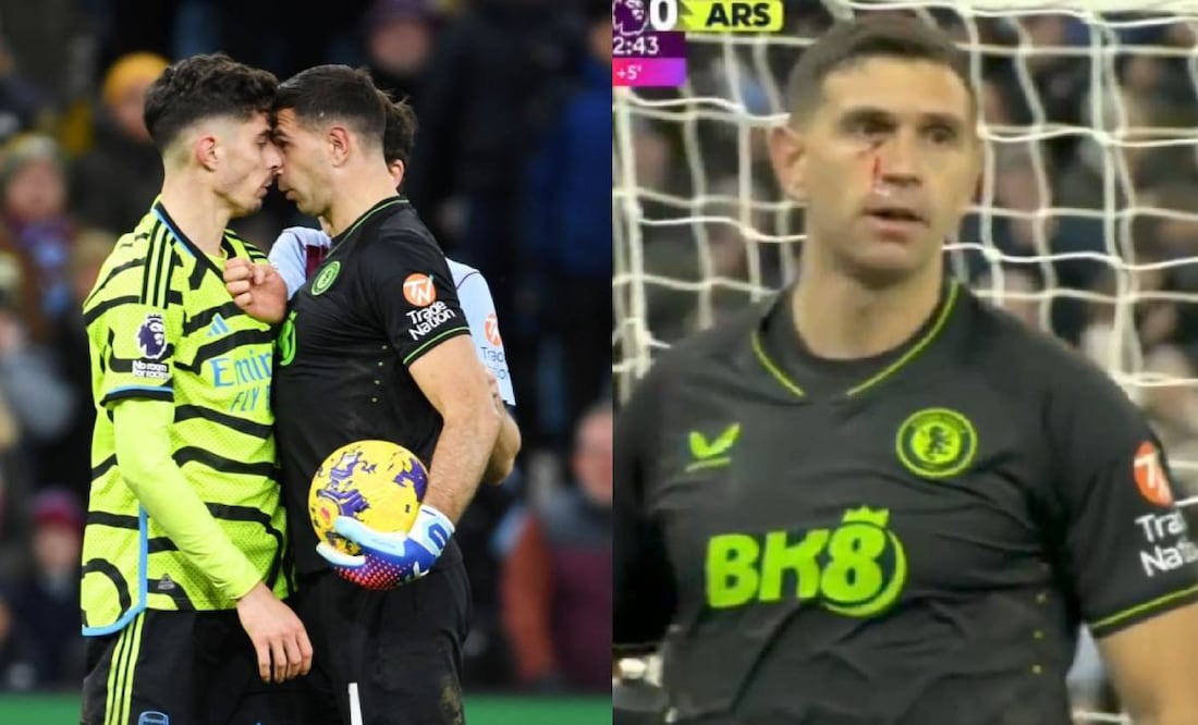El Dibu Martínez acabó con el rostro ensangrentado luego de un choque con Kai Havertz. Foto: Especial