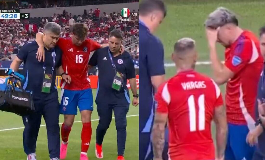 Igor Lichnovsky y Diego Valdés encendieron las alarmas del América con su lesiones en la Copa América. Foto: Especial