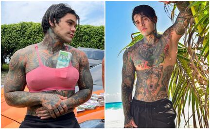 Influencer pierde apuesta y se pone implantes de senos