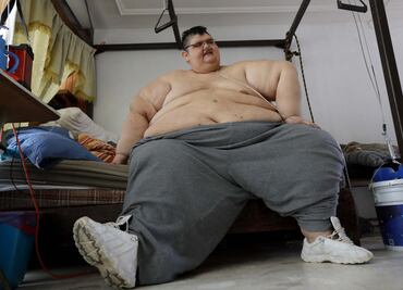 "El hombre más gordo del mundo" sobrevivió al coronavirus