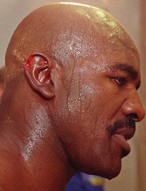 El día que Mike Tyson enloqueció y mordió la oreja de Holyfield