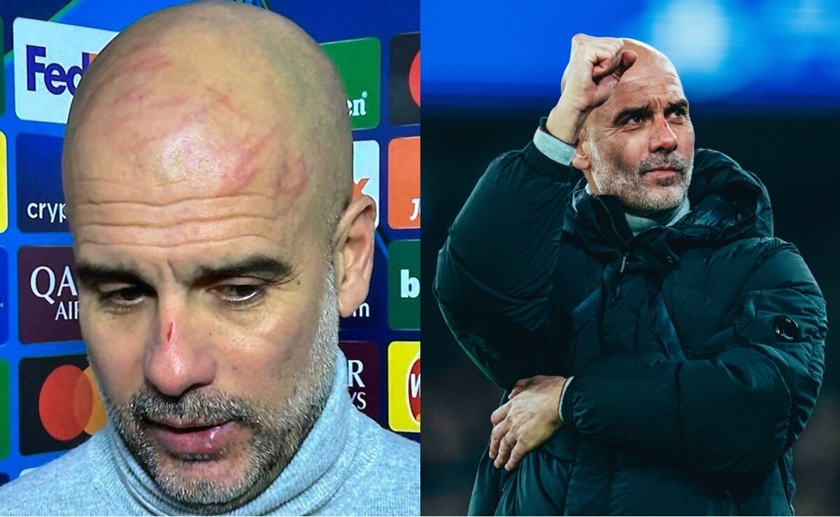 Pep Guardiola revela la razón por la que su cara tiene rasguños: 