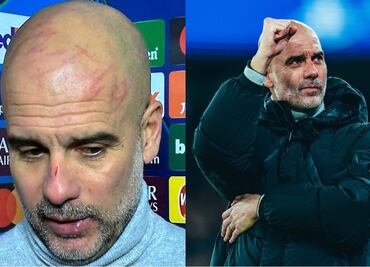 Pep Guardiola revela la razón por la que su cara tiene rasguños: "Me quería hacer daño"