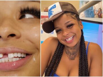 La influencer Chrisean Rock se tatúa el rostro de su ex novio ¡en un diente!