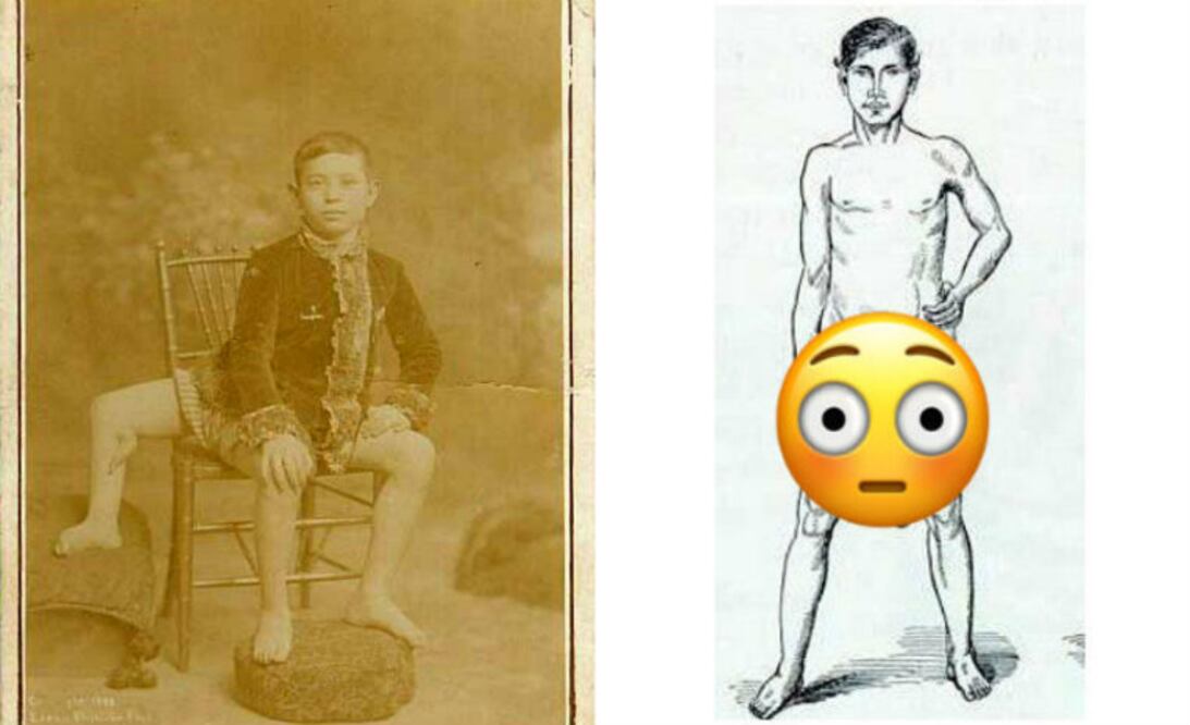 Foto: Wikipedia/Internet/Emojipedia